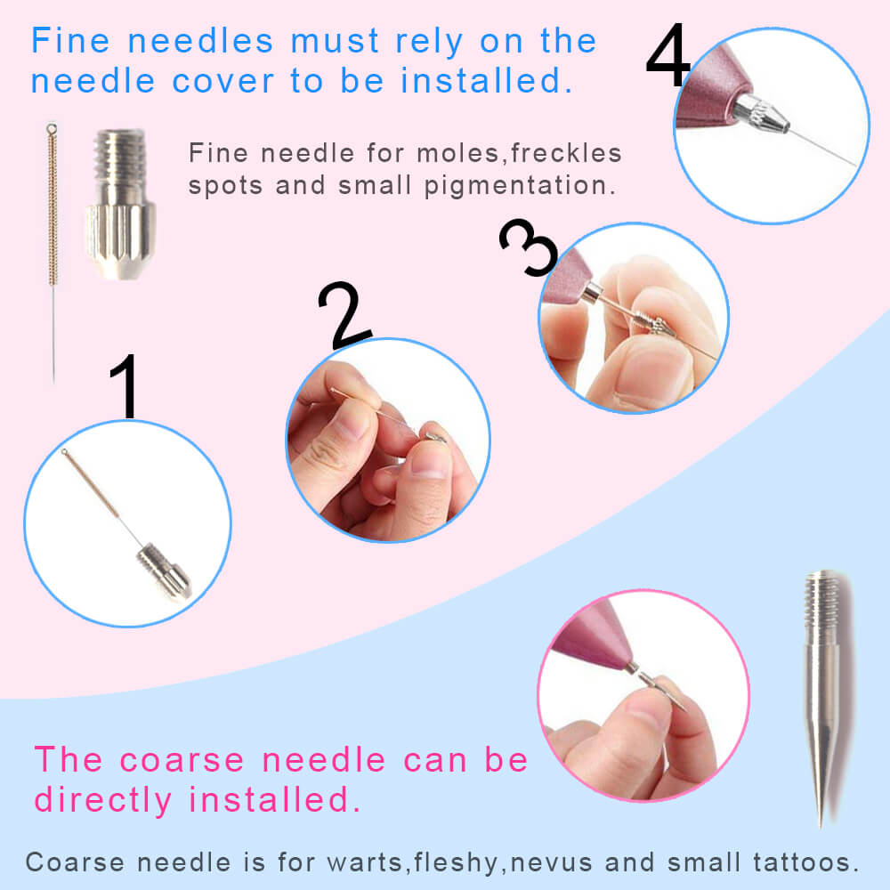 laser-plasma-pen-tattoo-remover.jpg