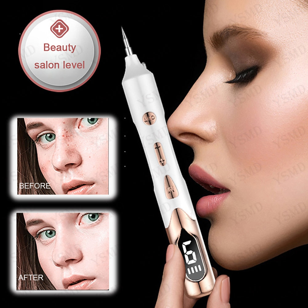 laser-plasma-pen-tattoo-remover.jpg
