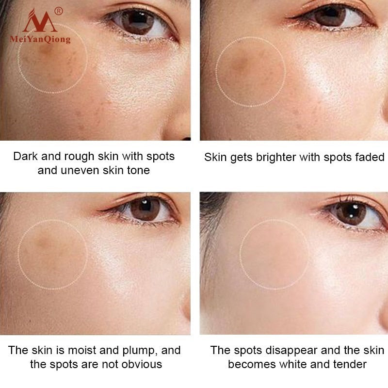 Anti-Aging Whitening Face Cream